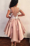 Chic Sheath Pink Above Knee Lace Appliques Cap Sleeve Homecoming Dresses